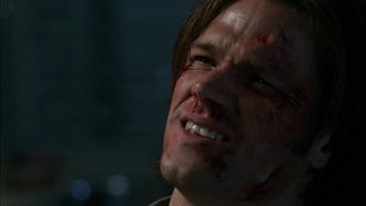Supernatural S06E07
