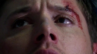 Supernatural S07E03
