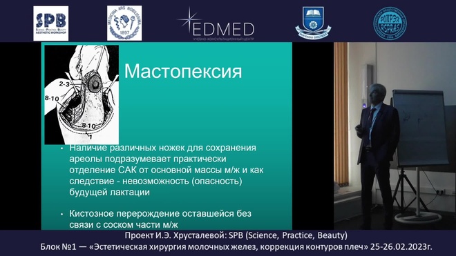 Органосохраняющая мастопексия. Эстетическая хирургия молочных желёз ...